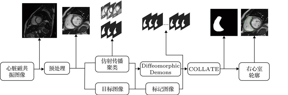 Flow diagram of right ventricular segmentation combined with multi-atlas and Diffeomorphic demons algorithm.结合多图谱和Diffeomorphic demons算法的右心室分割流程图