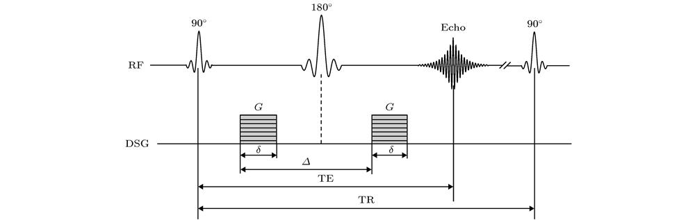 Stejskal-Tanner Scheme: Two diffusion sensitive gradients inserted before and after 180° RF refocusing pulse. G, amplitude; δ, duration of the DSG; Δ, time between the two sensitive gradient lobes.Stejskal-Tanner序列, 其中两个同等的DSG脉冲置于180°RF脉冲两侧, 强度为G, 宽度为δ, 时间间隔为Δ