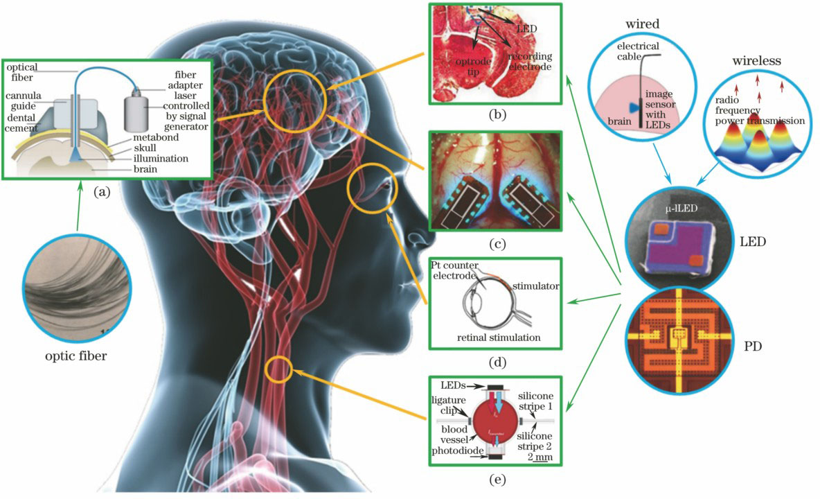Application schematic of implantable optoelectronic devices (a) Optogenetics with optical fiber[13]; (b) optogenetics probe[14]; (c) intracranial fluorescence imaging device[15]; (d) retinal prosthesis stimulator[16]; (e) extravascular oxygen monitor[17]