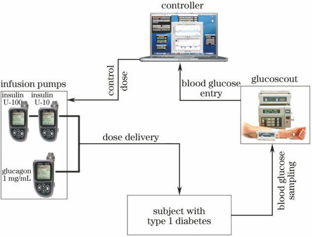 Bihormonal closed-loop insulin and glucagon delivery system[21]