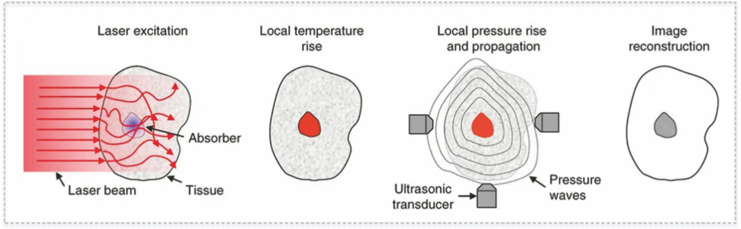 Schematic of photoacoustic imaging[1]
