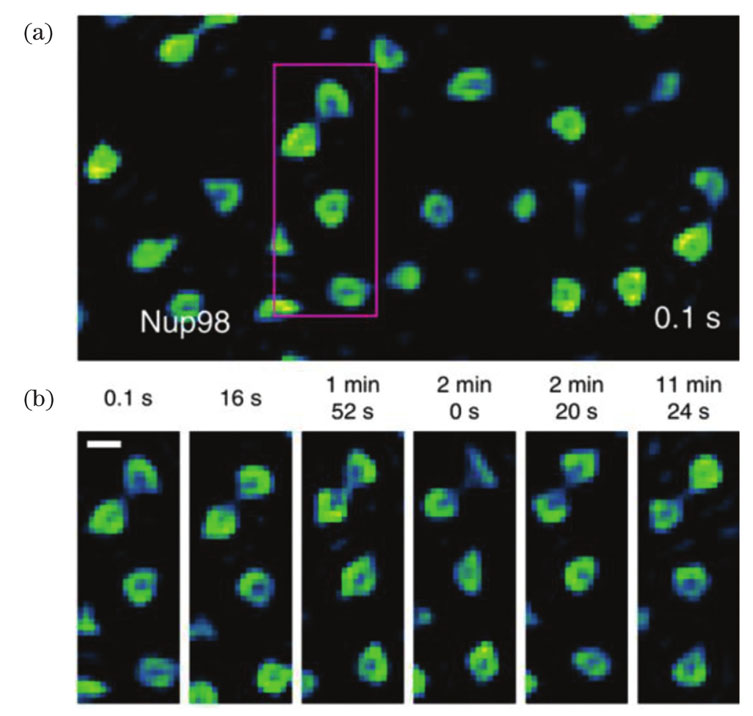 Dynamic process of nucleoporins resolved by Sparse-SIM[21]. (a) Sparse-SIM image of dynamic ring-shaped nuclear pores labeled with Nup98-GFP in live COS-7 cell; (b) magenta box in (a) is enlarged and shown at six time points