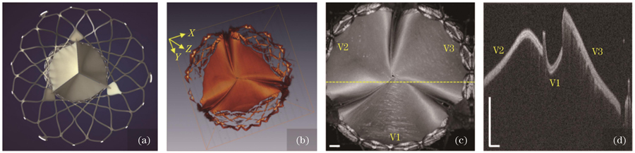 OCT structural imaging results of bioprosthetic valves-tricuspid valve (scale bar: 2 mm). (a) Schematic diagram of tricuspid valve stent; (b) three-dimensional OCT structure (Z-X-Y); (c) en-face (X-Y) image of three-dimensional OCT structure; (d) OCT structural cross-section, corresponding to the position of the dashed line in figure (c)