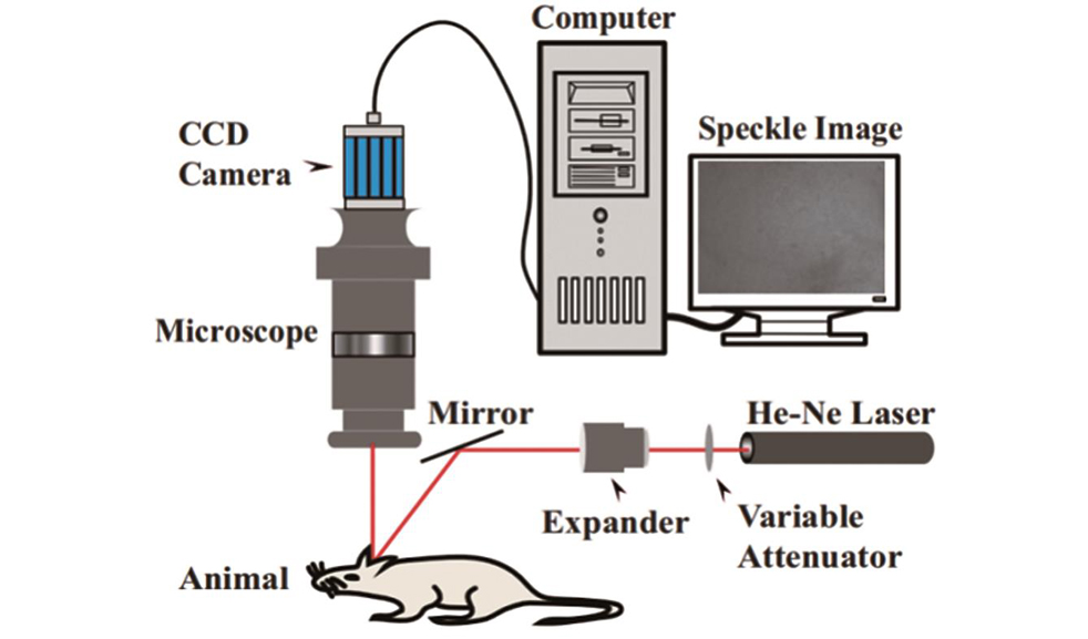 Schematic setup for laser speckle contrast imaging (LSCI)[30]