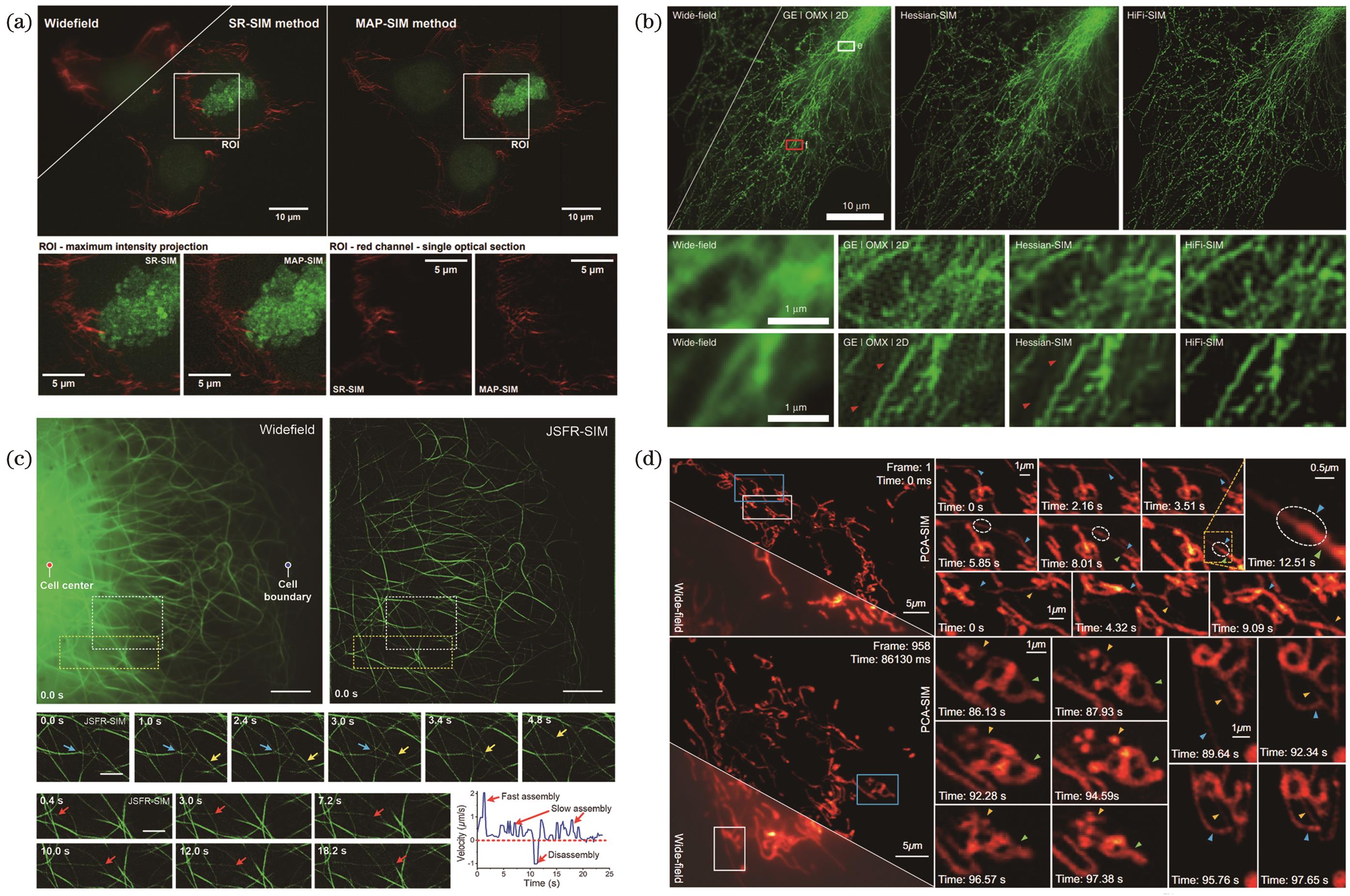 Super-resolution imaging results based on deconvolution algorithms in structured illumination microscopy. (a) Dual-color three-dimensional super-resolution images of actin (magenta) and chromatin (green) based on MAP-SIM[33]; (b) HiFi-SIM reconstruction of microtubules in COS-7 cells[35]; (c) visualization of microtubule dynamics based on JSFR-SIM[36]; (d) super-resolution reconstruction of dynamic processes in COS-7 mitochondria based on PCA-SIM[37]