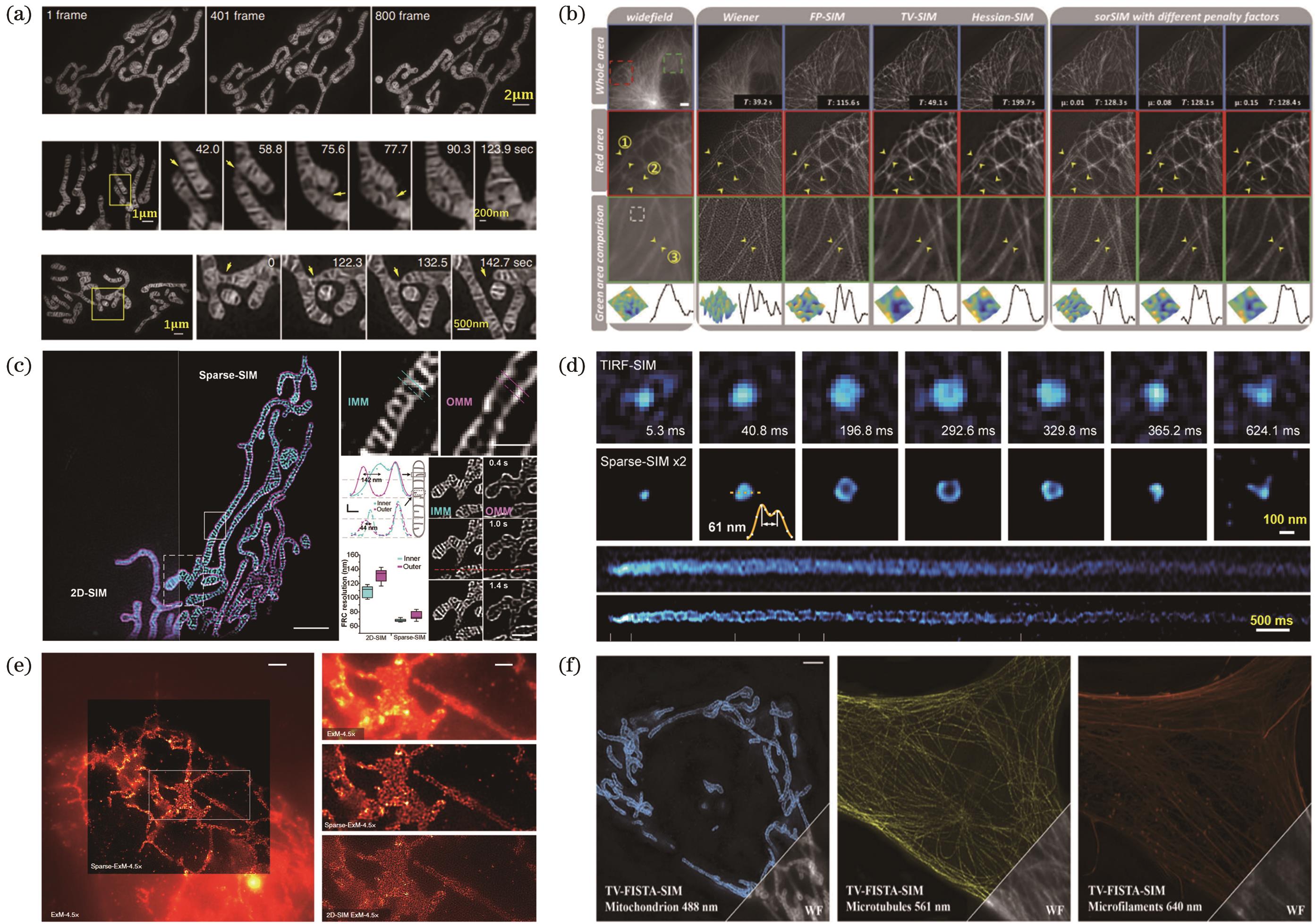 Super-resolution imaging results based on regularization deconvolution algorithms in structured illumination microscopy. (a) Dynamics of mitochondrial cristae structure in live cells based on Hessian-SIM[41]; (b) sorSIM reconstruction of microtubule-stained images in Vero cells[42]; (c) Sparse-SIM reconstruction of both inner and outer mitochondrial membranes in live COS-7 cells[8]; (d) super-fast imaging of fusion pores in INS-1 cells based on Sparse-SIM[8]; (e) super-resolution reconstruction results of Sparse-ExM[8]; (f) nulti-color 3D-SIM reconstruction of TV-FISTA-SIM (from left to right: outer mitochondrial membrane, microtubule protein, and actin imaging)45]