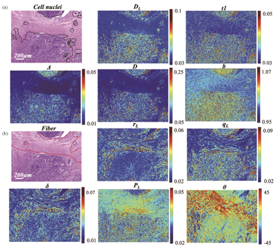 Images of polarization parameters of breast cancer tissues[38]. (a) Parameters DL, t1, Δ, D, and b correspond to the cell nuclei (labeled by the black solid line in the H&E stained image); (b) parameters rL, qL, δ, PL,and θ correspond to the fiber tissue (marked by the red solid line in the H&E stained image)